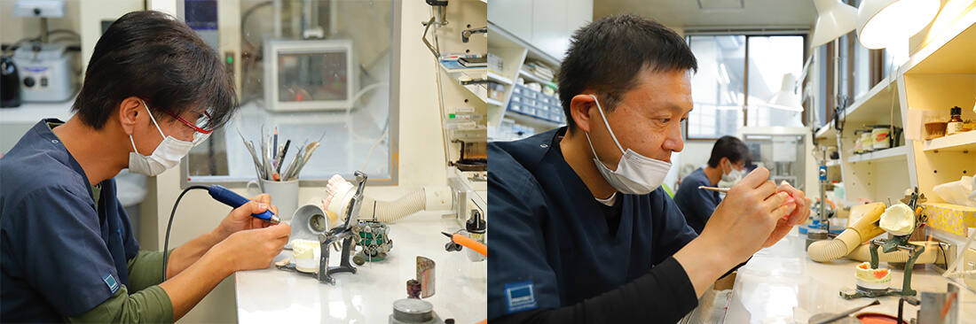院内技工士による補綴物の作製