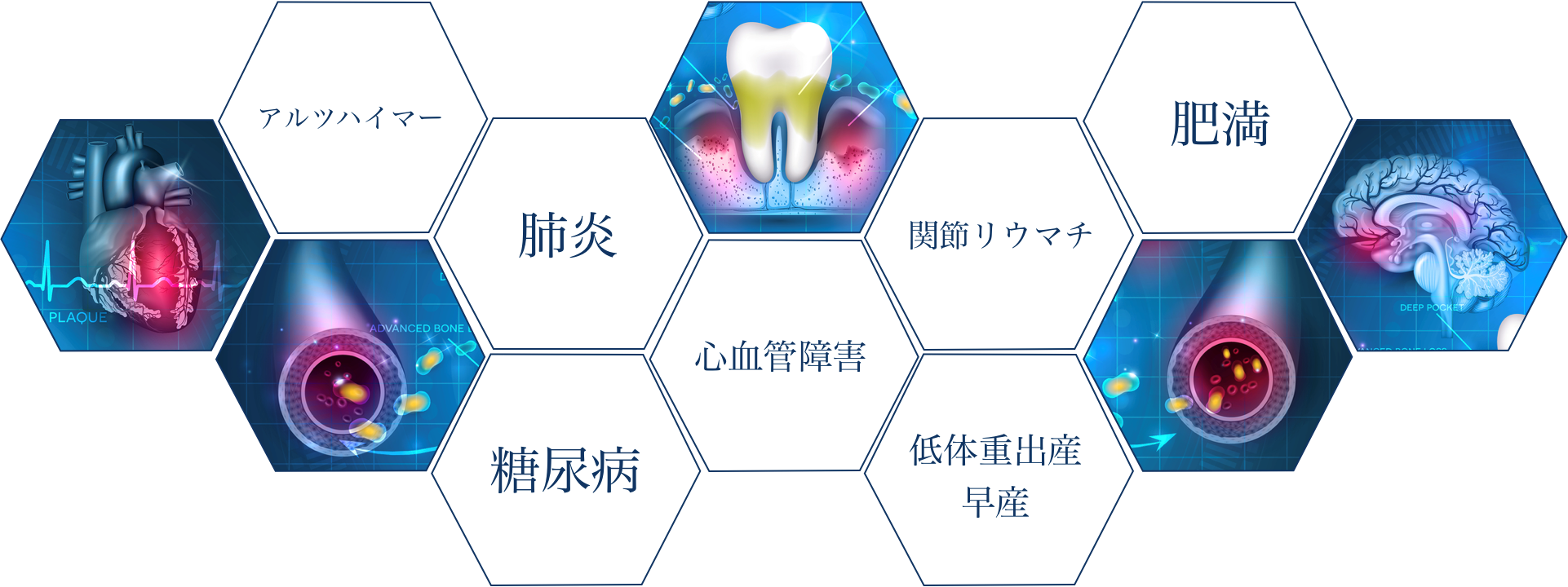 歯周疾患と全身疾患の関連性