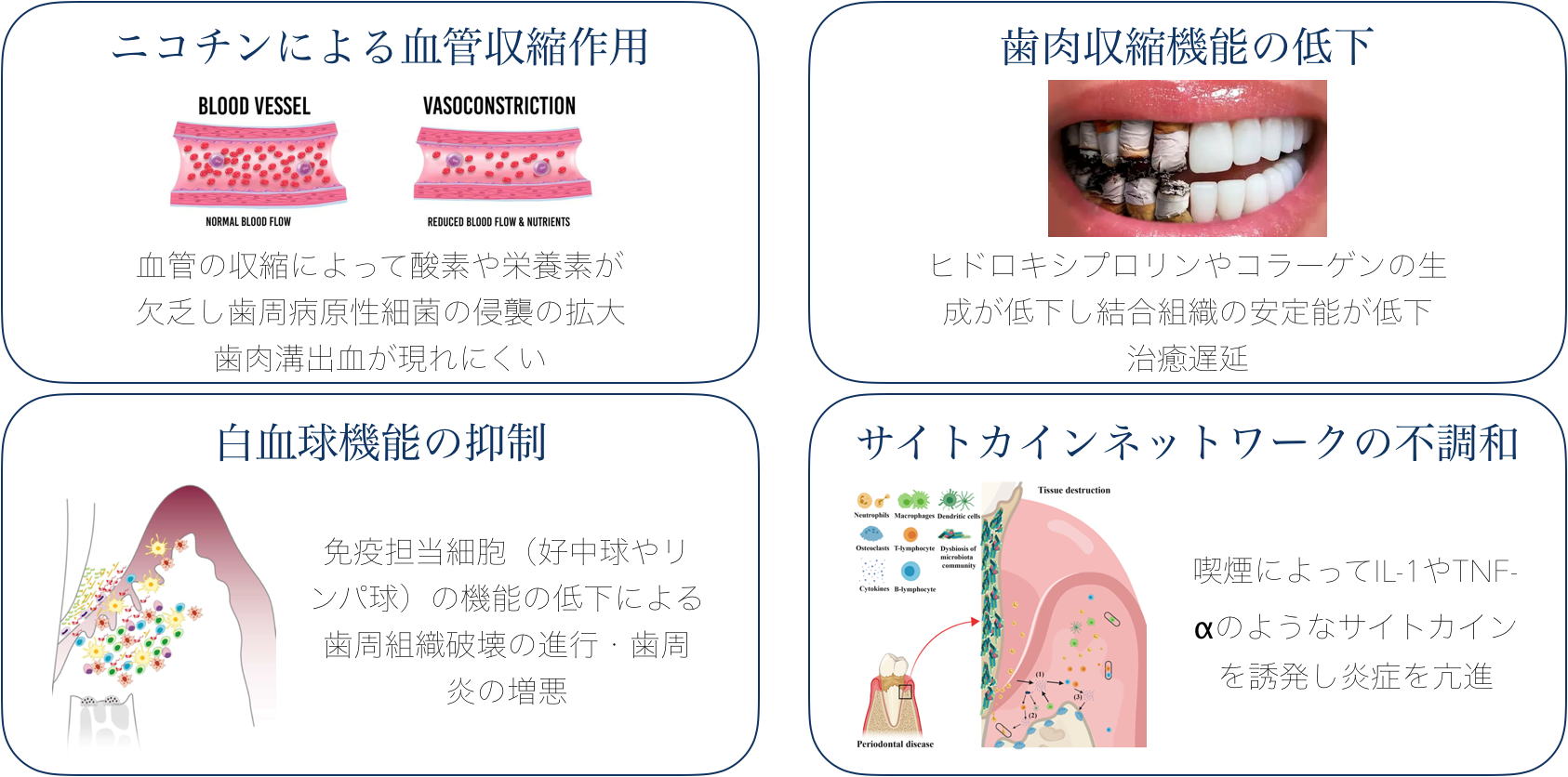 喫煙の歯周組織に与える影響